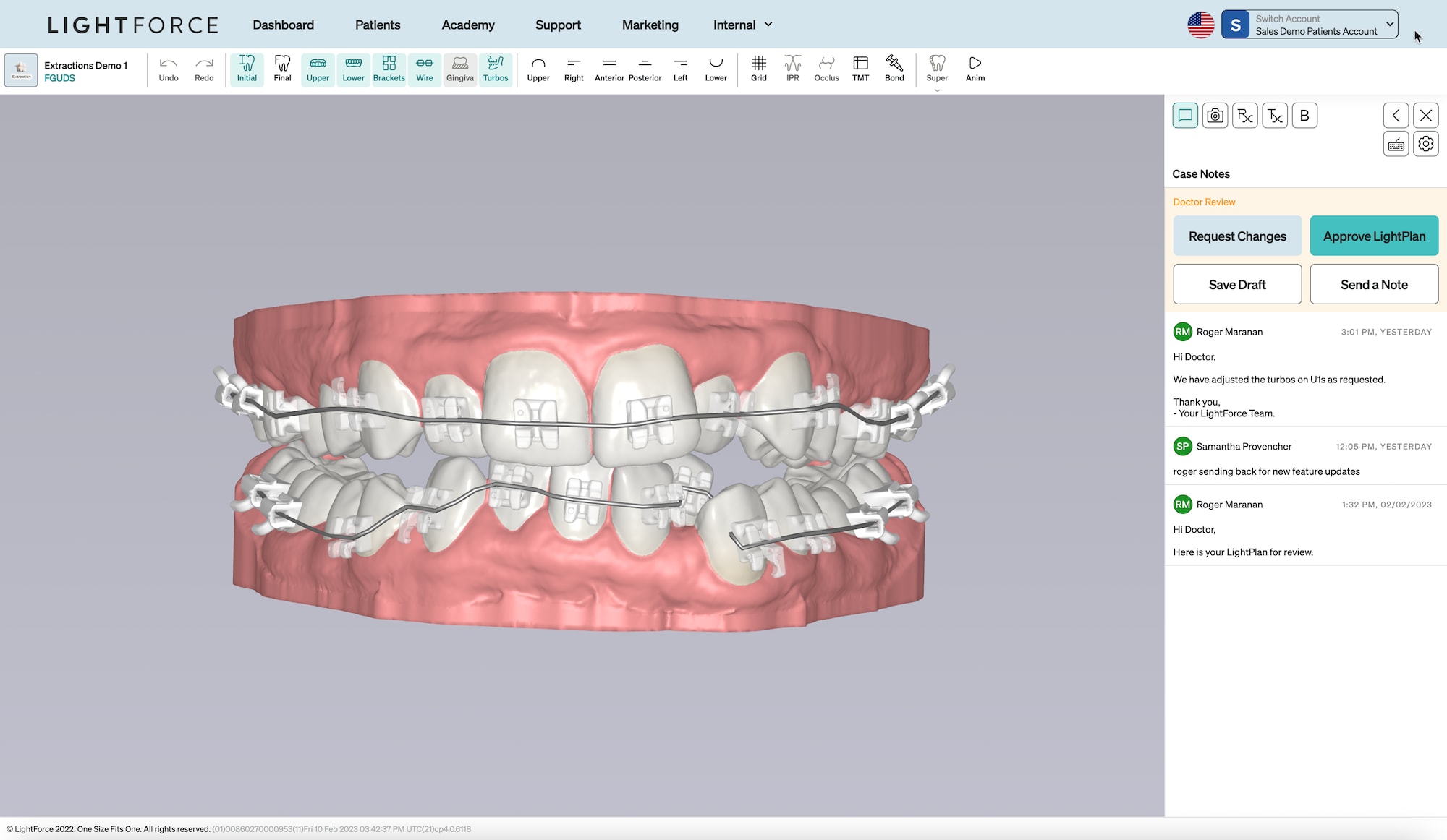Screenshot of  the fully integrated LightForce system with 3D-printed ceramic braces and digital plans personalized