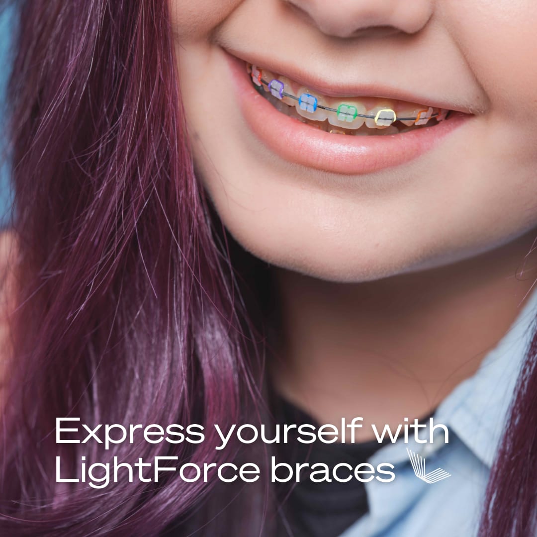 Braces that encourage you to stand out 2 copy 3