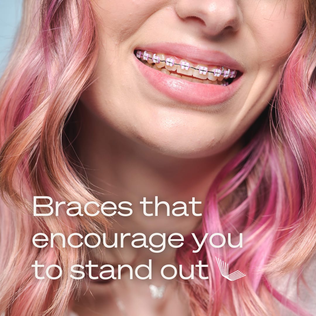 Braces that encourage you to stand out