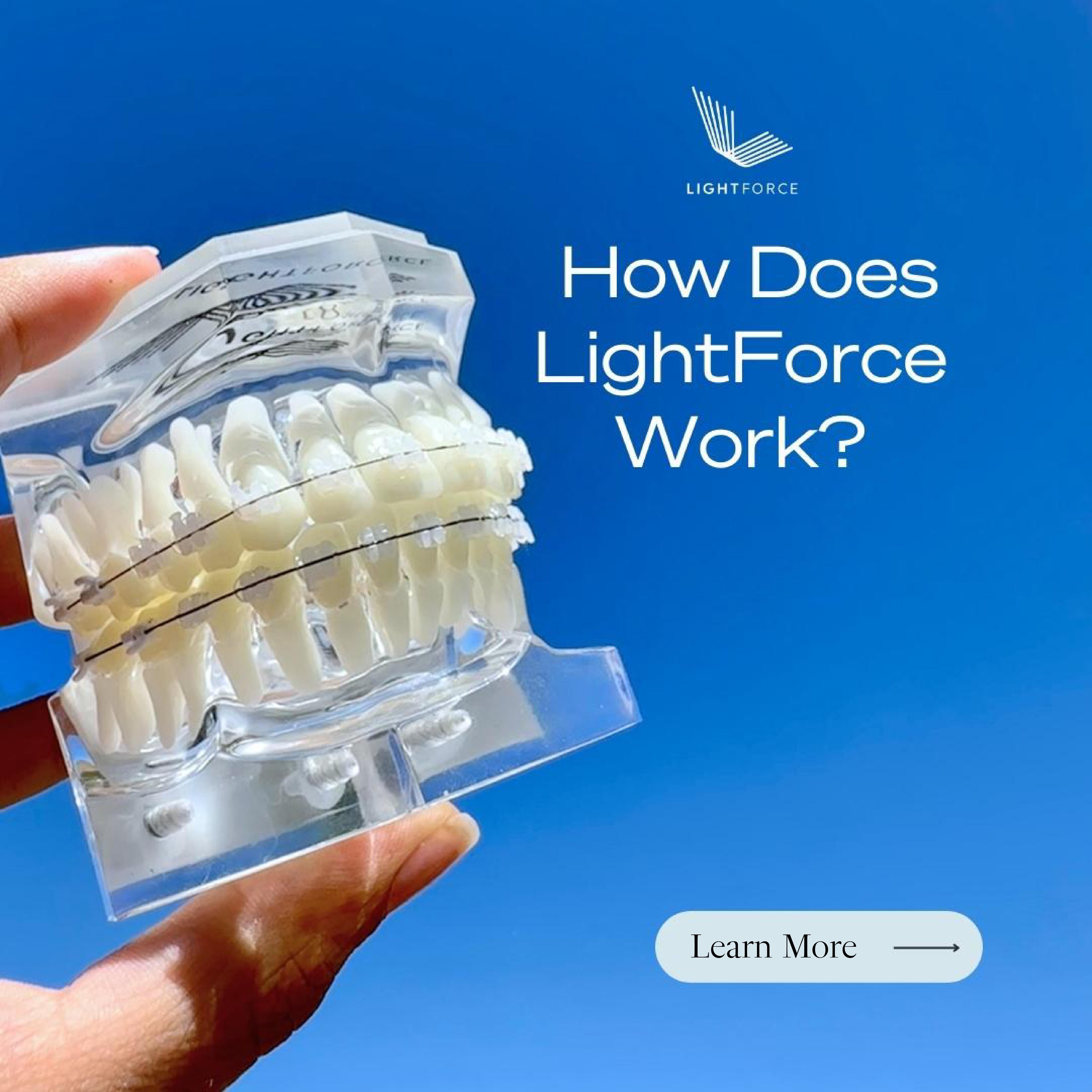 LightForce LightForce