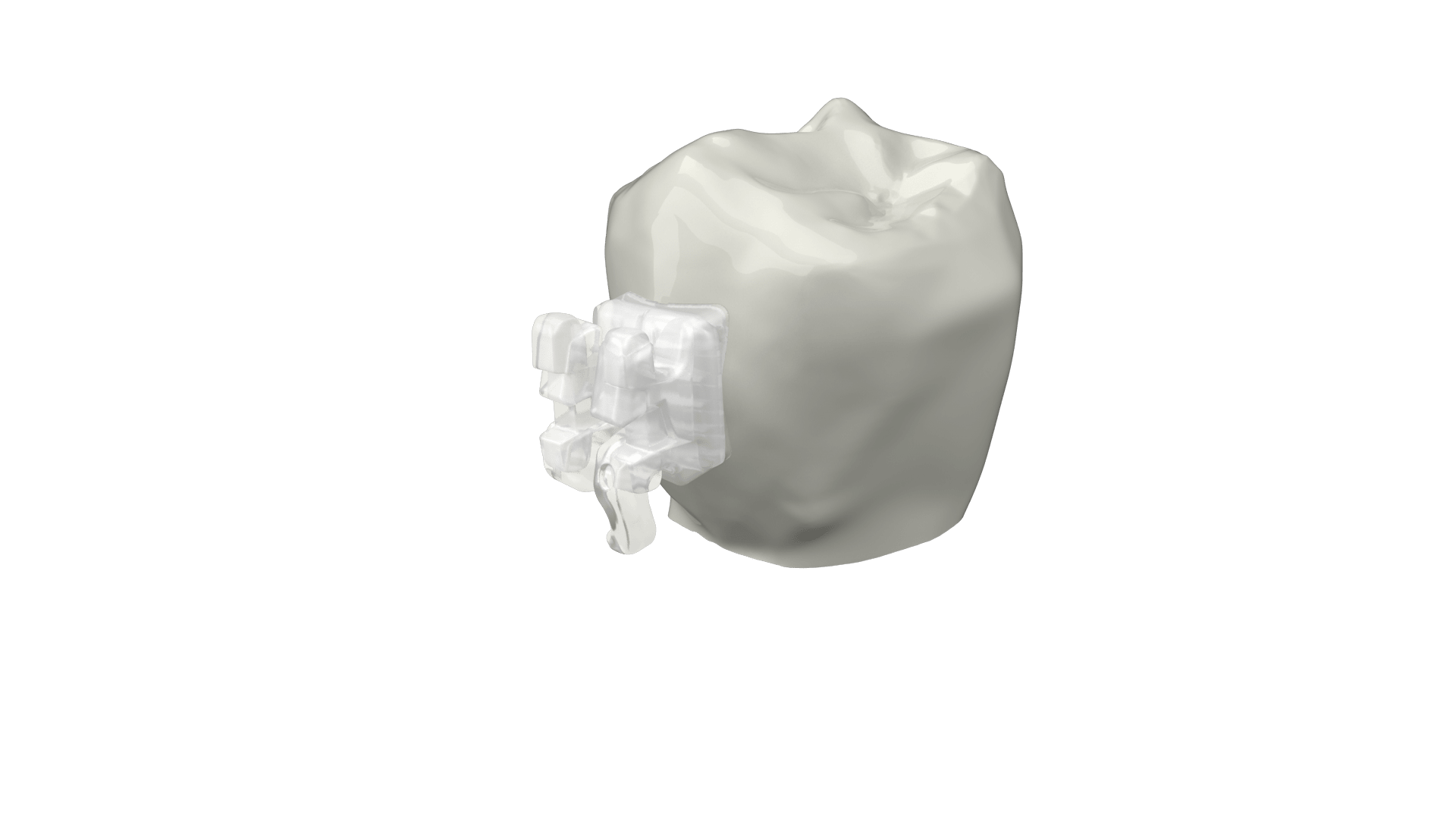 Tooth and Clear Bracket